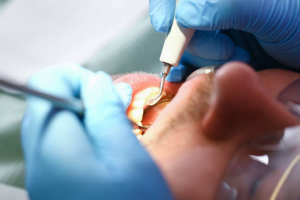 Best Emergency Treatment for Jaw Pain or Injury in Bowmansville, PA